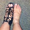 Kim Kardashian postou foto em seu Instagram mostrando os pés inchados
