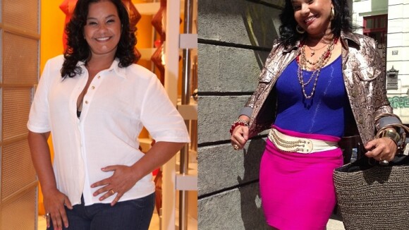 Após perder 32 kg com redução de estômago, Solange Couto quer operar seios