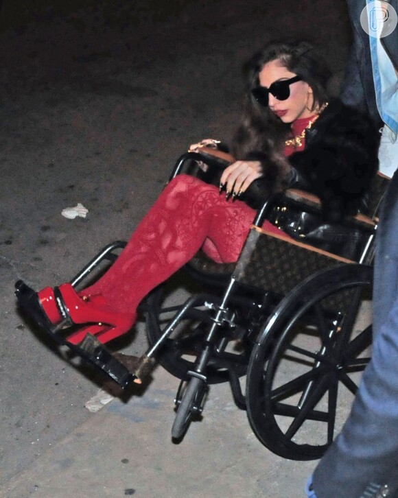 Lady Gaga ainda se recupera da cirurgia que fez no quadril, no começo do ano