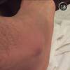 Gusttavo Lima mostrou o pé inchado em vídeo no Snapchat
