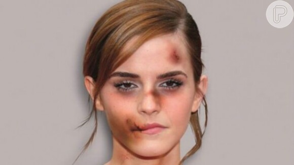 'A violência doméstica é um 'câncer social' que pode afetar qualquer pessoa', disse Palombo (Emma Watson faz parte da campanha)