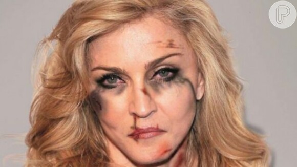 Madonna foi uma das famosas que autorizou a manipulação de suas fotos e as colocou com os rostos marcados por hematomas e ferimentos