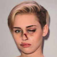 Miley Cyrus e famosas surgem machucadas em campanha contra violência doméstica