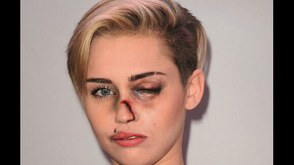 Miley Cyrus e famosas surgem machucadas em campanha contra violência doméstica