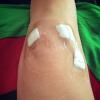 Após cirurgia devido a lesão do joelho direito, Luana Piovani postou foto demonstrando que já está melhor