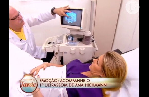 Ana Hickmann terá a gravidez acompanhada por equipes da TV Record até o nascimento do filho