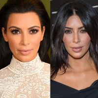 Kim Kardashian, Angelina Jolie e outras famosas fizeram bichectomia. Veja fotos!