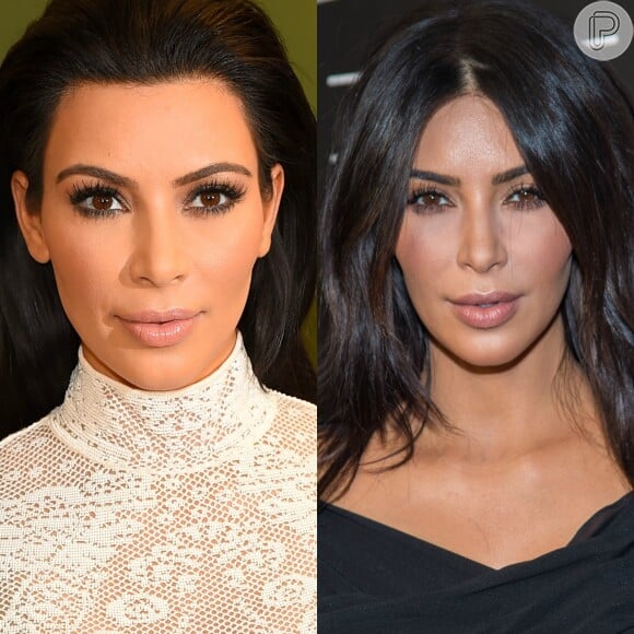 Kim Kardashian é uma das famosas que aderiu a bichectomia, técnica que afina o rosto