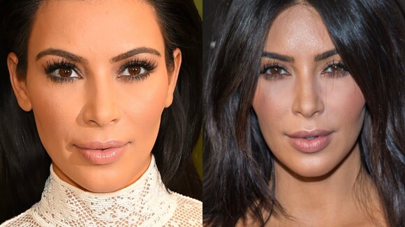 Kim Kardashian, Angelina Jolie e outras famosas fizeram bichectomia. Veja fotos!