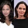 Angelina Jolie é outra famosa internacional que se submeteu ao procedimento capaz de reduzir as bochechas