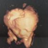 Heloisy Oliveira mostra foto de ultrassonografia do filho, Zion