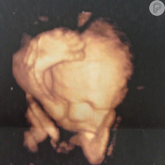 Heloisy Oliveira mostra foto de ultrassonografia do filho, Zion