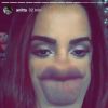 Anitta brincou sobre o preenchimento dos lábios em sua conta no Instagram Stories nesta segunda-feira, 28 de novembro de 2016