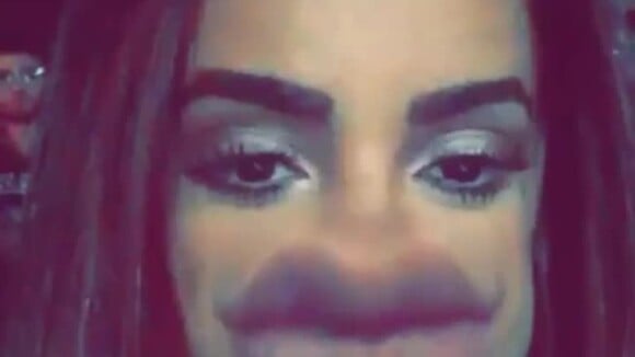 Anitta ironiza preenchimento labial em vídeo: 'Deu errado, o que faço agora?'