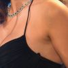 Anitta explicou por que está retirando a tatuagem de clave de sol no ombro: 'Enjoei'