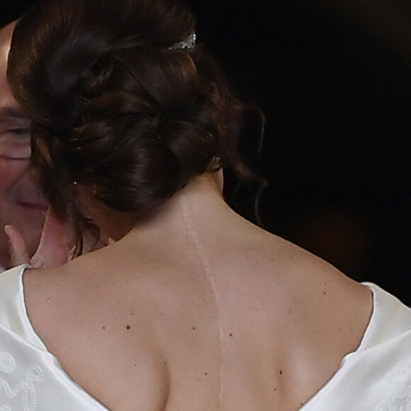 Eugenie de York quis deixar a cicatriz de uma cirurgia de escoliose à mostra em seu vestido de casamento