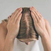 Couro cabeludo precisa de proteção solar: 'Esquecem que também é pele'