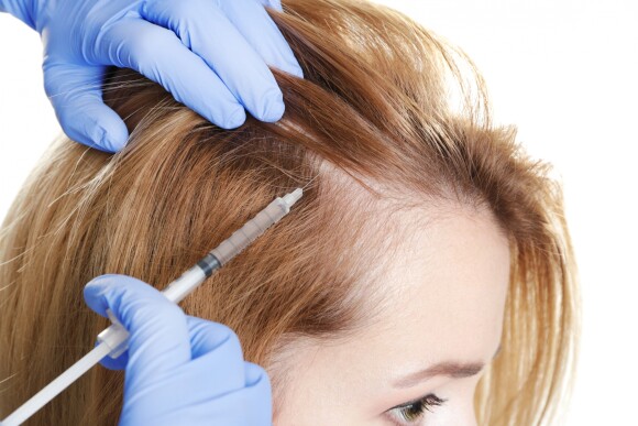 Mesoterapia é uma técnica minimamente invasiva de injeções com substâcias no couro cabeludo que estimula o crescimento do cabelo