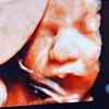 1ª foto de Zyan: filho de Giovanna Ewbank aparece em ultrassom 3D