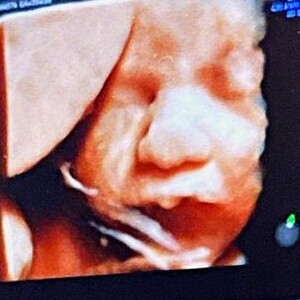 1ª foto de Zyan: filho de Giovanna Ewbank aparece em ultrassom 3D