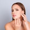 Veja receitas para melhorar a pele com acne 