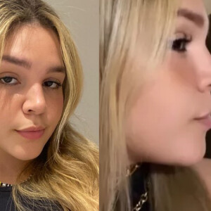 Filha de Simony, Aysha Benelli mostra antes e depois de rinoplastia e surpreende seguidores