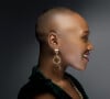 A alopecia tem diferentes causas: algumas delas são menos agressivas que outras