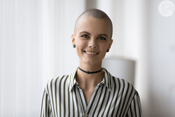Alopecia pode ter relação com outras doenças autoimunes, como o lupus