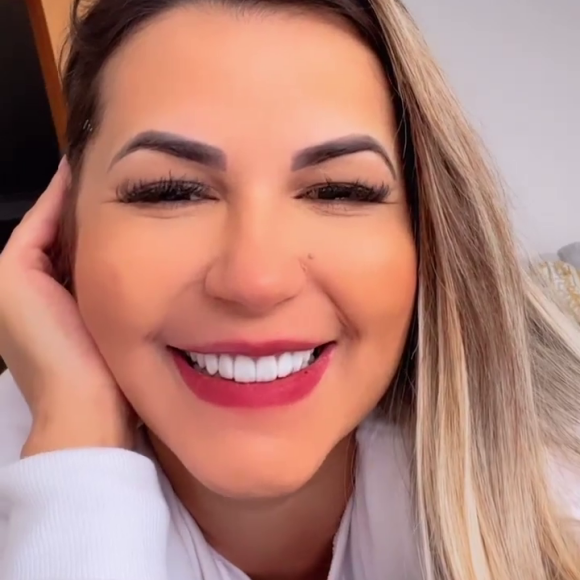 Sem preenchimento labial, Deolane Bezerra se mostrou surpresa: 'Tá diminuindo mais ainda'