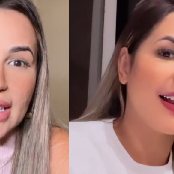 Deolane Bezerra retira preenchimento labial. Confira antes e depois!