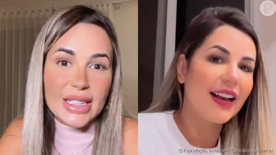 Deolane Bezerra Antes E Depois Doutora Retira Preenchimento Labial E