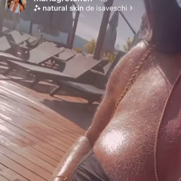 Corpo peludo de Gretchen dividiu opiniões entre os internautas. 'De onde surgiu tanto pelo?', disparou um seguidor 