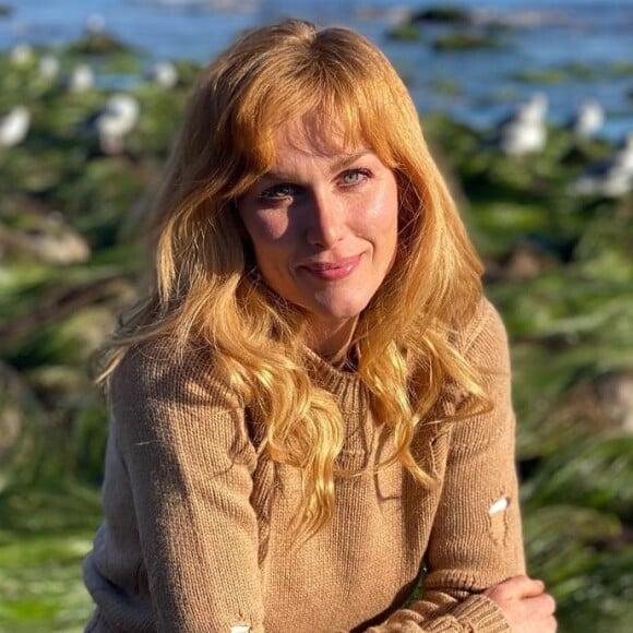 Diagnosticada com esclerose múltipla, Ludmila Dayer falou sobre o processo de descoberta da doença