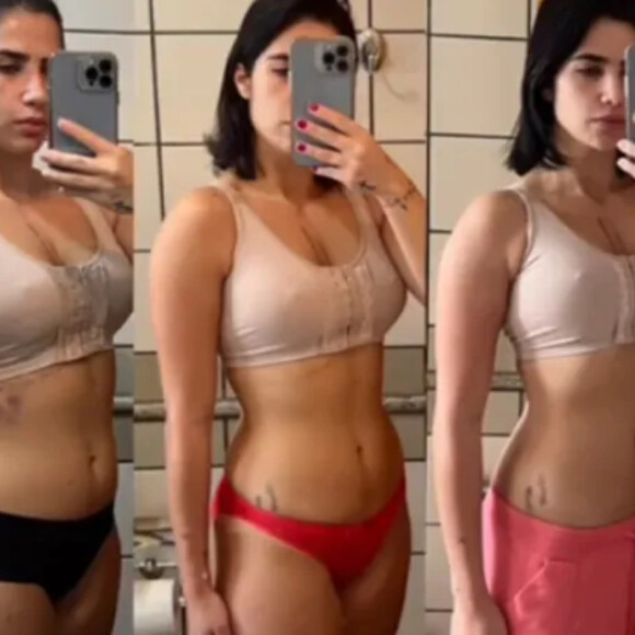Jéssica Costa colocou implantes de silicone nas mamas e perdeu peso durante a recuperação