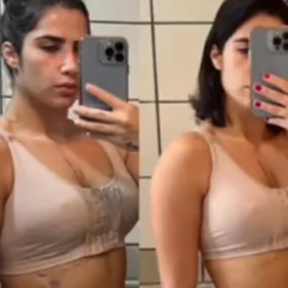 Jéssica Costa mostrou antes e depois das próteses de silicone nos seios