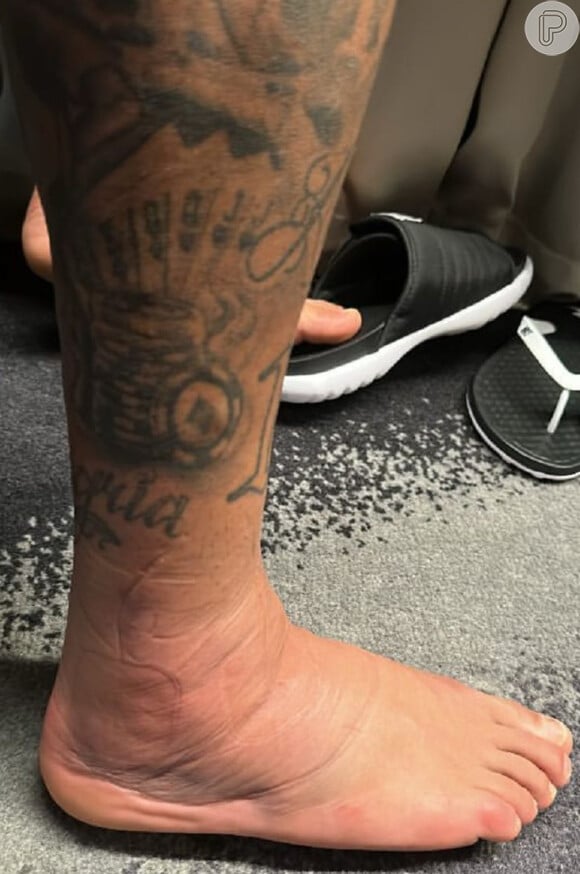 Neymar mostrou tornozelo inchado