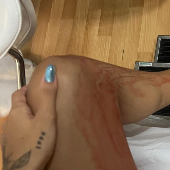 Gabi Brandt teve um sangamento forte e descobriu que estava com placenta prévia