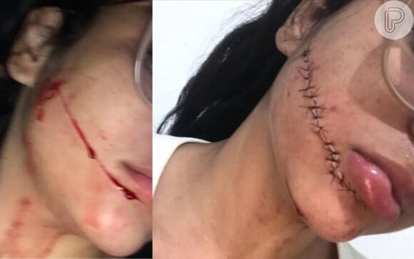 Mulher encontrada com a faca que agrediu Stefani Firmo continua solta