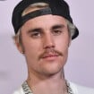 Justin Bieber acusa marca de usar sua imagem sem autorização e expert dá dicas para não violar direito autoral
