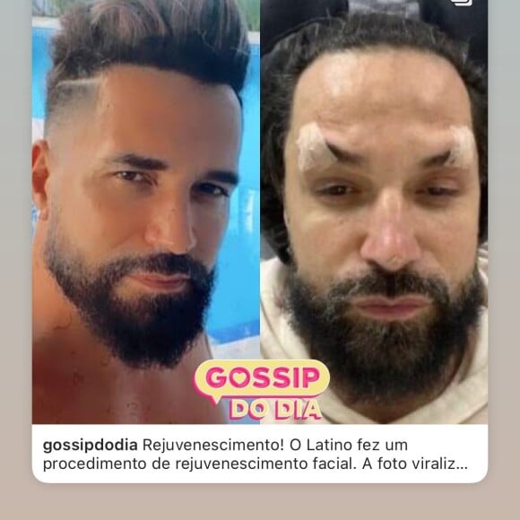 O antes e depois de Latino chocou a web