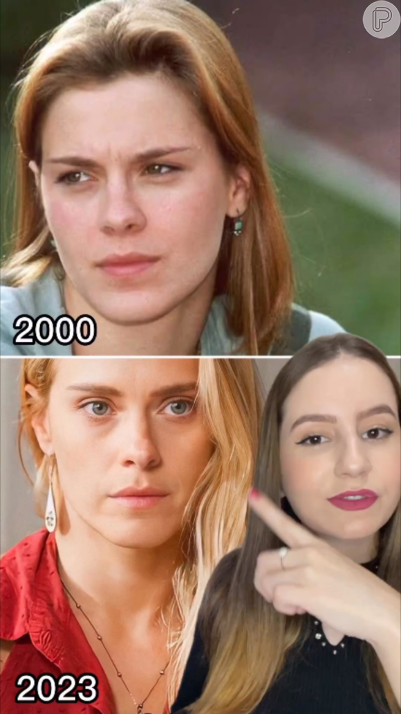 Carolina Dieckmann usou preenchimento labial? Especialistas comparou fotos da atriz com 23 anos de diferença e os lábios permanecem os mesmos