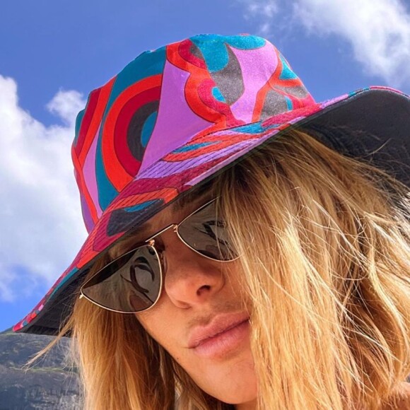 Carolina Dieckmann realiza tratamento com laser para a pele