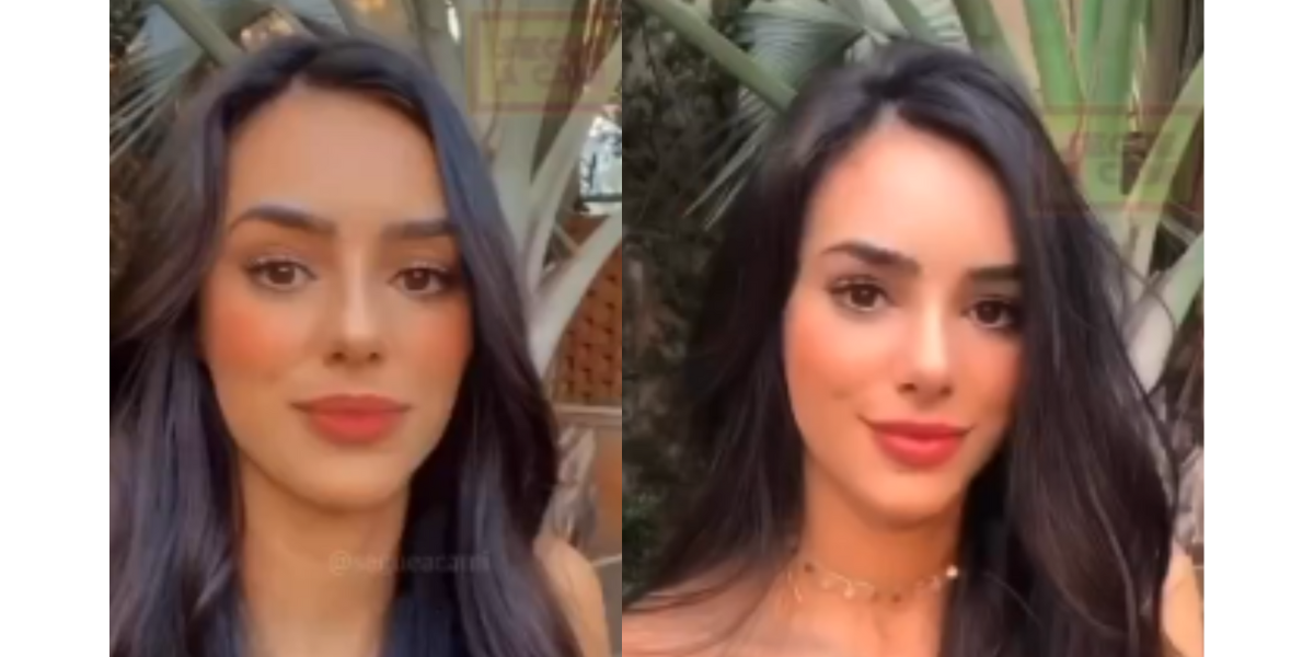 Foto Bruna Biancardi Antes E Depois Da Rinoplastia Purepeople Sexiezpix Web Porn 