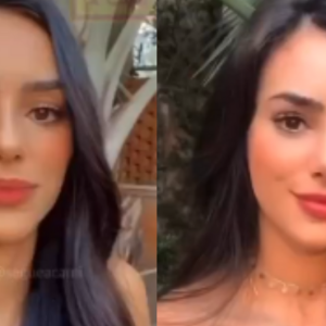 Bruna Biancardi antes e depois da rinoplastia