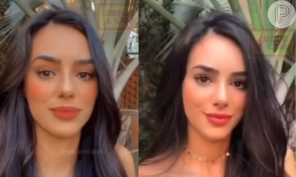 Bruna Biancardi antes e depois da rinoplastia