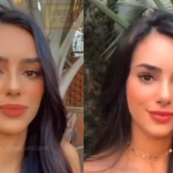 Bruna Biancardi antes e depois da rinoplastia