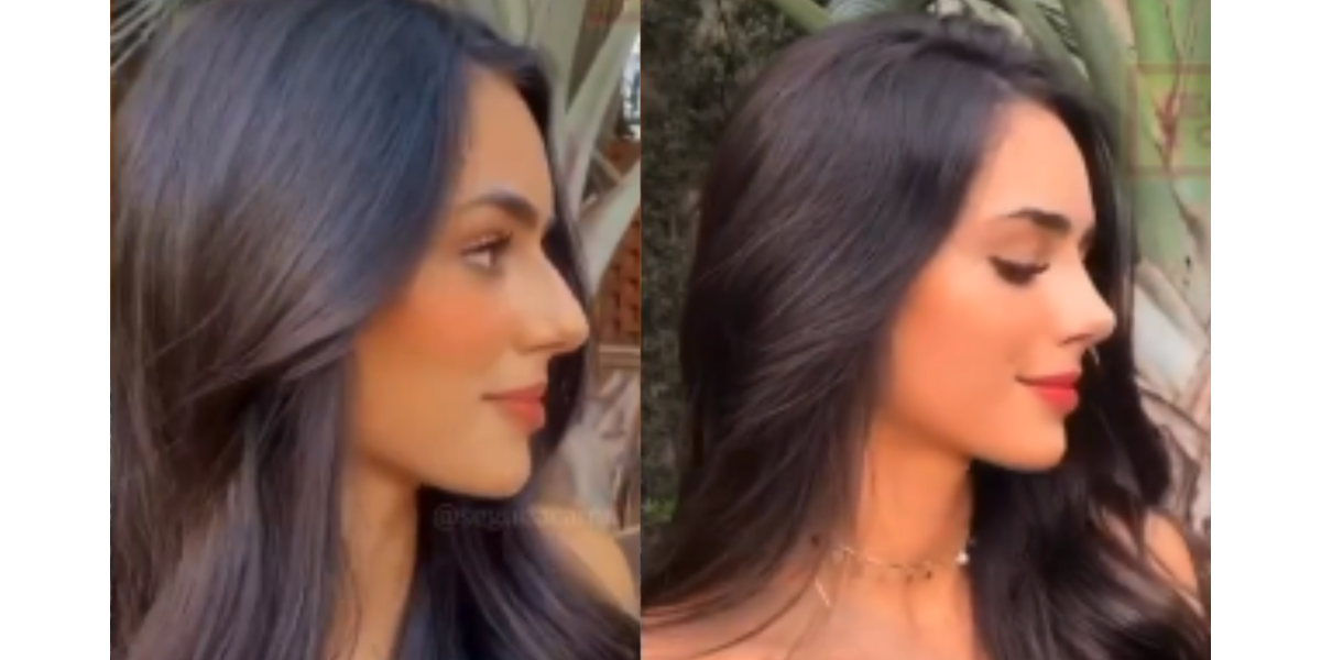 Foto Antes E Depois De Bruna Biancardi Rinoplastia Garantiu Um Novo Perfil Para A