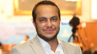 Que diferença! Lutando contra a calvície, Thammy Miranda apela para transplante de cabelo e mostra resultado