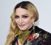 Madonna apresentou sintomas nos dias que precederam a internação em uma UTI, segundo o TMZ
