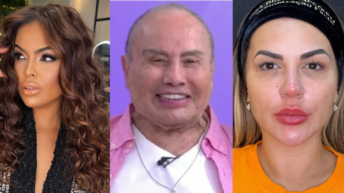 Harmonização facial dos famosos: veja celebridades que se